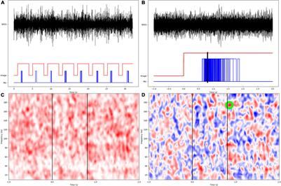 Neuronal Circuits Supporting Development of Visual Naming Revealed by Intracranial Coherence Modulations